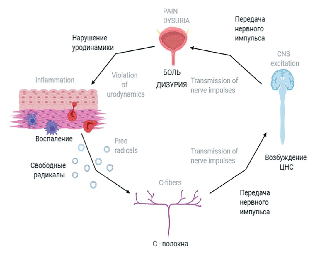  Схема патогенетических изменений с участием свободных радикалов при хроническом рецидивирующем цистите у женщин