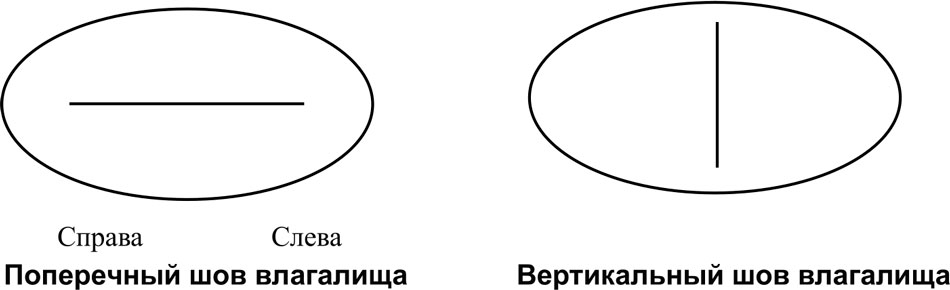 Анкета оценки тазовой боли