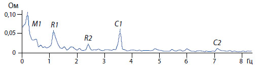 Периодические компоненты спектра импеданса мочевого пузыря экспериментальной крысы, выявляемые Фурье анализом.