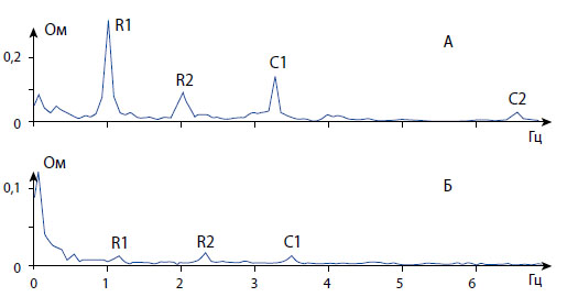 Периодические компоненты спектра импеданса мочевого пузыря экспериментальной крысы в нормальных условиях (А) и после нарушения магистрального кровообращения (Б).
