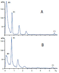 Пример изменений амплитуды основных пиков в спектре импеданса мочевого пузыря крысы перед (А) и в конце(В)инфузионной цистометрии. 
