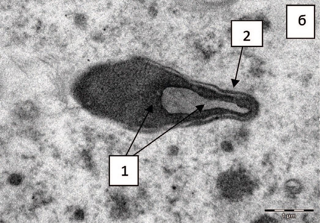 Fig. 3. Spermatozoa heads