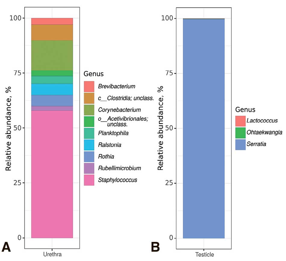 Таксономический состав бактериального сообщества исследуемых образцов на уровне родов, выявленный методом секвенирования ампликонов гена 16S рРНК. A – Микробиота уретры. B – Микробиота ткани яичка