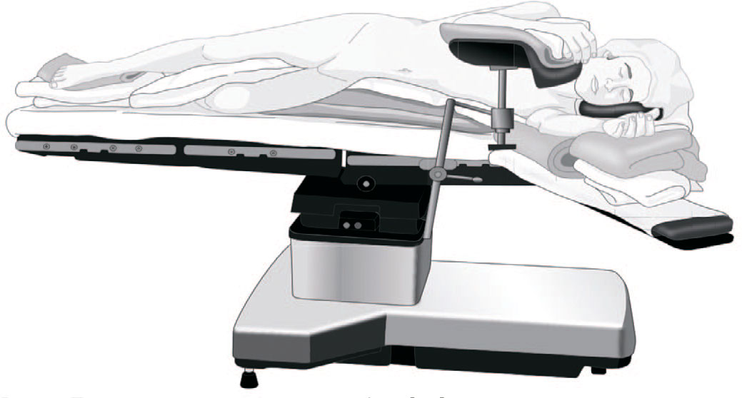 Положение пациента лежа на боку [23]