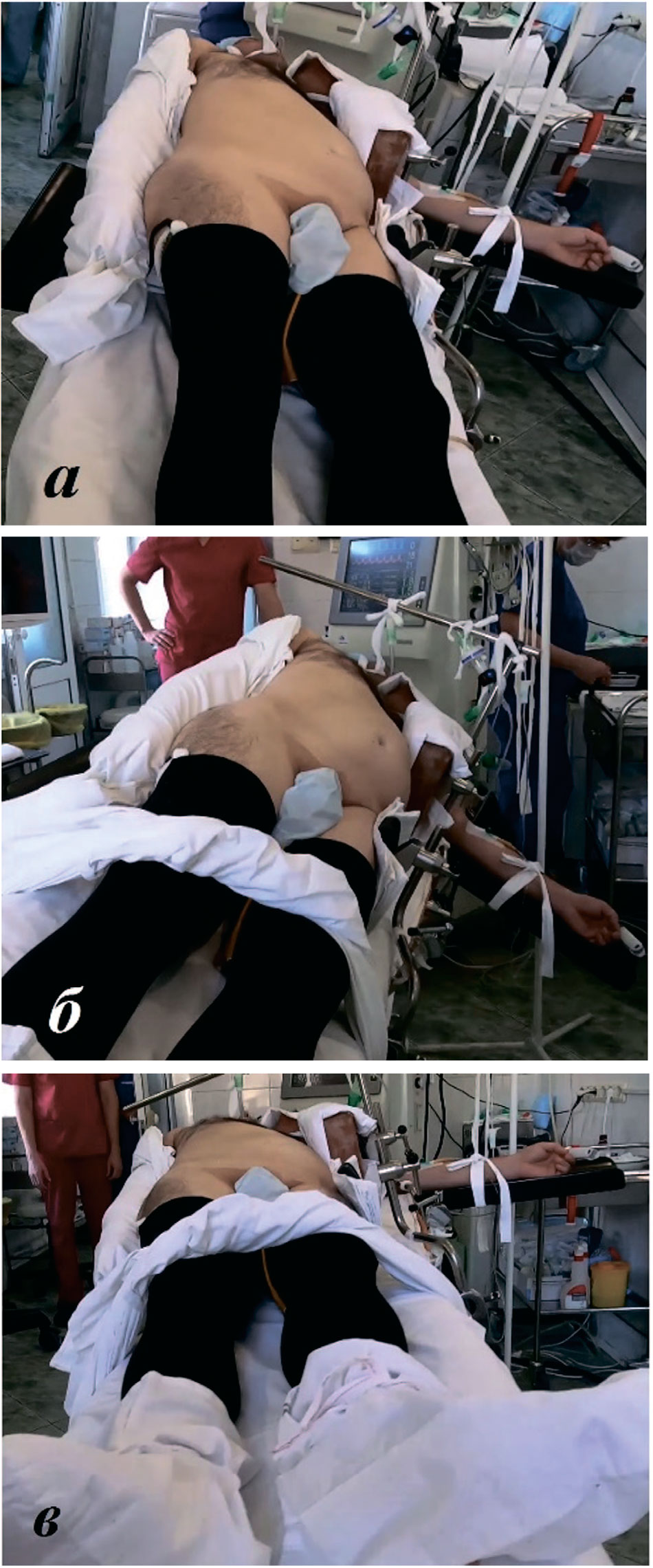 Модифицированная укладка пациентов лежа на боку [25]