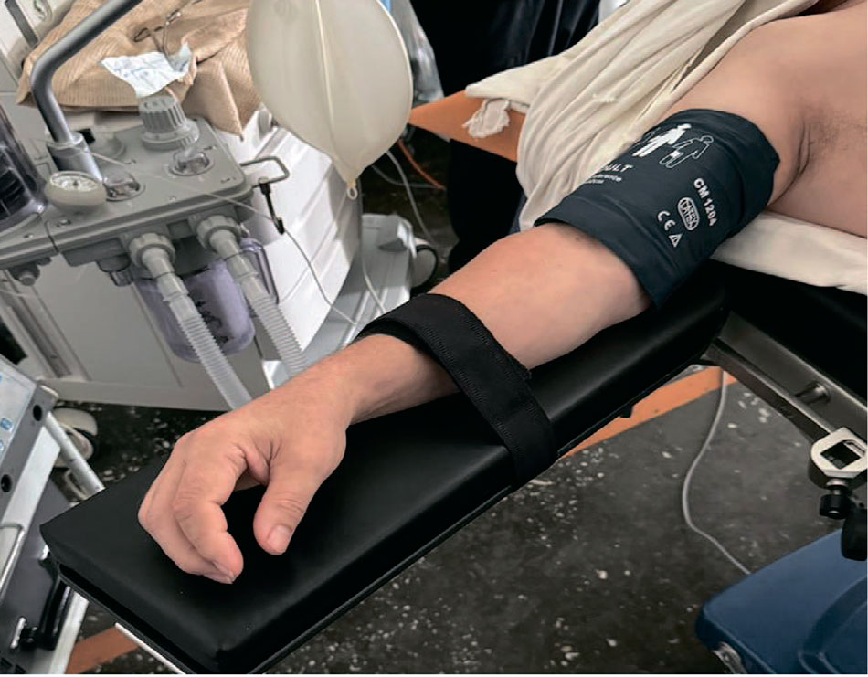 Укладка верхней конечности [27