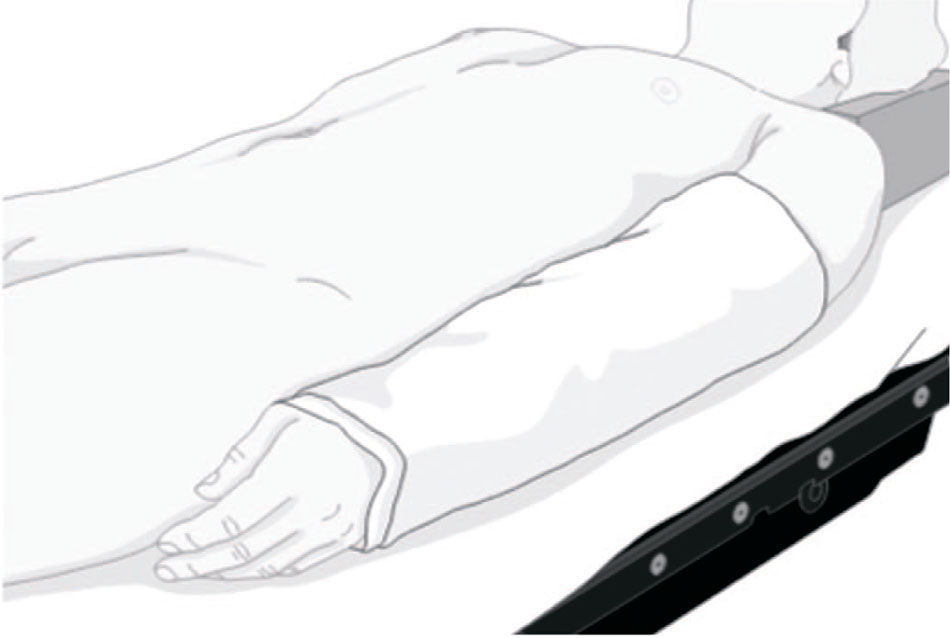 Верхняя конечность в нейтральном положении уложена вдоль тела, фиксирована простыней [23]